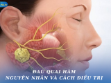 ĐAU QUAI HÀM: NGUYÊN NHÂN VÀ CÁCH ĐIỀU TRỊ
