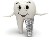 CẮM GHÉP RĂNG IMPLANT LÀ GÌ ? LỢI ÍCH CỦA VIỆC CẮM GHÉP RĂNG IMPLANT ?