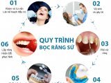 QUY TRÌNH BỌC RĂNG TOÀN SỨ KHÔNG ĐAU