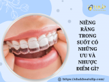 NIỀNG RĂNG TRONG SUỐT CÓ NHỮNG ƯU VÀ NHƯỢC ĐIỂM GÌ?