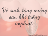 VỆ SINH RĂNG MIỆNG SAU KHI TRỒNG RĂNG IMPLANT 