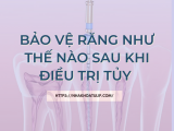 BẢO VỆ RĂNG NHƯ THẾ NÀO SAU KHI ĐIỀU TRỊ TỦY