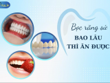 BỌC RĂNG SỨ BAO LÂU THÌ ĂN ĐƯỢC