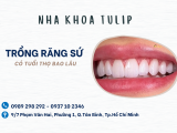 TRỒNG RĂNG SỨ CÓ TUỔI THỌ BAO LÂU